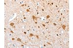 The image on the left is immunohistochemistry of paraffin-embedded Human brain tissue using CSB-PA784753(AEBP2 Antibody) at dilution 1/25, on the right is treated with fusion protein. (Original magnification: 
