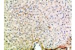 Immunohistochemical analysis of paraffin-embedded human-liver, antibody was diluted at 1:200