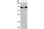 Gel: 6%SDS-PAGE,Lysate: 40 