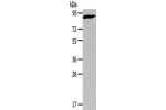 Gel: 6%SDS-PAGE,Lysate: 40 