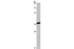 Gel: 10%SDS-PAGE, Lysate: 40 