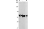 Gel: 8%SDS-PAGE, Lysate: 40 