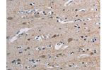 The image on the left is immunohistochemistry of paraffin-embedded Human brain tissue using CSB-PA790562(TONSL Antibody) at dilution 1/45, on the right is treated with fusion protein. (Original magnification: 
