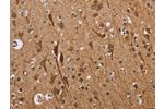 The image on the left is immunohistochemistry of paraffin-embedded Human brain tissue using CSB-PA791777(ETV7 Antibody) at dilution 1/40, on the right is treated with fusion protein. (Original magnification: 