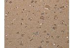 The image on the left is immunohistochemistry of paraffin-embedded Human brain tissue using CSB-PA791908(CAB39 Antibody) at dilution 1/40, on the right is treated with synthetic peptide. (Original magnification: 