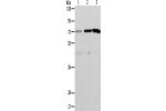 Gel: 10%SDS-PAGE, Lysate: 40 