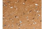 The image on the left is immunohistochemistry of paraffin-embedded Human brain tissue using CSB-PA796881(GNAZ Antibody) at dilution 1/25, on the right is treated with synthetic peptide. (Original magnification: 