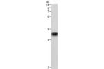 Gel: 6%SDS-PAGE, Lysate: 40 
