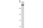 Gel: 6%SDS-PAGE, Lysate: 40 