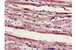 Immunohistochemistry of paraffin-embedded human heart tissue using CSB-PA800226LA01HU at dilution of 1:100