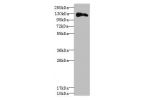 Western blot<br />
All lanes: ANLNantibody at 3.43ug/ml+ Hela whole cell lysate<br />
 Goat polyclonal to rabbit at 1/10000 dilution<br />
Predicted band size: 125,121 kDa<br />
Observed band size: 124 kDa<br />