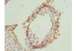 Immunohistochemistry of paraffin-embedded human testis tissue using CSB-PA800281ESR2HU at dilution 1:100