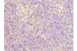 Immunohistochemistry of paraffin-embedded human thymus tissue using CSB-PA801237LA01HU at dilution of 1:100