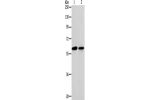 Gel: 10%SDS-PAGE, Lysate: 40 