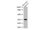 Western Blot<br />
Positive WB detected in:Mouse skeletal muscle tissue<br />
All lanes: ANKRD23 antibody at 2.5ug/ml<br />
Secondary<br />
Goat polyclonal to rabbit IgG at 1/50000 dilution<br />
Predicted band size: 35,30 kDa<br />
Observed band size: 35