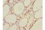 Immunohistochemistry of paraffin-embedded human thyroid tissue using CSB-PA803123ESR1HU at dilution 1:100