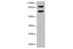 Western blot<br />
All lanes: DTX2 antibody at 1ug/ml+ HepG-2 whole cell lysate<br />
Goat polyclonal to rabbit at 1/10000 dilution<br />
Predicted band size: 68,63 kDa<br />
Observed band size: 67 kDa,92Da