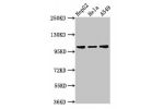 Western Blot<br />
Positive WB detected in:HepG2 whole cell lysate,Hela whole cell lysate,A549 whole cell lysate<br />
All lanes:CHD1L antibody at 3