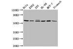 Western Blot<br />
Positive WB detected in:Hela whole cell lysate,K562 whole cell lysate,293 whole cell lysate,HL-60 whole cell lysate,MCF-7 whole cell lysate,Rat stomach tissue<br />
All lanes:GATAD2A antibody at 2.9