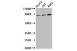 Western Blot<br />
Positive WB detected in:HepG2 whole cell lysate,293 whole cell lysate,K562 whole cell lysate<br />
All lanes:CDH7 antibody at 5.5