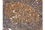 The image on the left is immunohistochemistry of paraffin-embedded Human tonsil tissue using CSB-PA805573(GNA13 Antibody) at dilution 1/20, on the right is treated with fusion protein. (Original magnification: 
