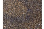 The image on the left is immunohistochemistry of paraffin-embedded Human tonsil tissue using CSB-PA806953(CXXC5 Antibody) at dilution 1/25, on the right is treated with fusion protein. (Original magnification: 