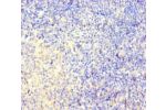 Immunohistochemistry of paraffin-embedded human pancreatic tissue using CSB-PA808540LA01HU at dilution of 1:100