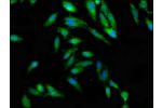 Immunofluorescence staining of Hela cells with CSB-PA808994LA01HU at 1:100, counter-stained with DAPI. The cells were fixed in 4% formaldehyde, permeabilized using 0.2% Triton X-100 and blocked in 10% normal Goat Serum. The cells were then incubated with 