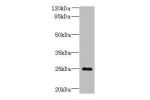 Western blot<br />
All lanes: C11orf53 antibody at 0.8ug/ml+Mouse gonadal tissue<br />
Goat polyclonal to rabbit at 1/10000 dilution<br />
Predicted band size: 25 kDa<br />
Observed band size: 25 kDa<br />