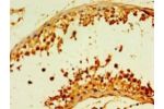 Immunohistochemistry of paraffin-embedded human testis tissue using CSB-PA810265LA01HU at dilution 1:100
