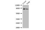 Western Blot<br />
Positive WB detected in:Rat liver tissue,Rat lung tissue<br />
All lanes:DENND1C antibody at 3
