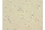 Immunohistochemistry of paraffin-embedded human brain tissue CSB-PA810284ESR1HU at dilution 1:100