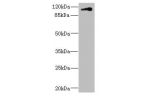 Western blot<br />
All lanes: CNTN4 antibody IgG at 1.79ug/ml+ HepG-2 whole cell lysate<br />
Secondary<br />
Goat polyclonal to rabbit IgG at 1/10000 dilution<br />
Predicted band size: 114,32,77 kDa<br />
Observed band size: 113 kDa<br />