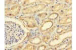 Immunohistochemistry of paraffin-embedded human kidney tissue using CSB-PA810307LA01HU at dilution of 1:100