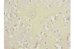 Immunohistochemistry of paraffin-embedded human brain tissue using CSB-PA811610LA01HU at dilution of 1:100