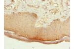 Immunohistochemistry of paraffin-embedded human skin tissue using CSB-PA812902LA01HU at dilution of 1:100