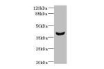Western blot<br />
All lanes: Dlk2 antibody at 5ug/ml+Mouse kidney tissue<br />
Goat polyclonal to rabbit at 1/10000 dilution<br />
Predicted band size: 41,46,45 kDa<br />
Observed band size: 40 kDa<br />