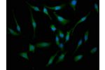 Immunofluorescence staining of Hela cells with CSB-PA814219LA01HU at 1:133,counter-stained with DAPI. The cells were fixed in 4% formaldehyde, permeabilized using 0.2% Triton X-100 and blocked in 10% normal Goat Serum. The cells were then incubated with t