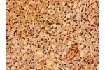 Immunohistochemistry of paraffin-embedded human adrenal gland tissue using CSB-PA814245LA01HU at dilution of 1:100