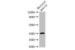 Western Blot<br />
Positive WB detected in:Mouse skeletal muscle tissue<br />
All lanes:ELMOD2 antibody at 3
