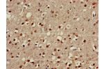 Immunohistochemistry of paraffin-embedded human brain tissue using CSB-PA816892HA01HU at dilution of 1:100