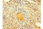 Immunohistochemistry of paraffin-embedded human ovarian tissue using CSB-PA818258LA01HU at dilution of 1:100