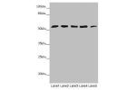 Western blot<br />
All lanes:CEP57L1 antibody at 6.26 ug/ml<br />
Lane 1 : CEM whole cell lysate<br />
Lane 2 : 293T whole cell lysate<br />
Lane 3 : Hela whole cell lysate<br />
Lane 4 : Jurkat whole cell lysate<br />
Lane 5 : A549 whole cell lysate<br /