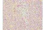 Immunohistochemistry of paraffin-embedded human tonsil tissue using CSB-PA818266ESR2HU at dilution of 1:100