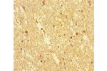 Immunohistochemistry of paraffin-embedded human brain tissue using CSB-PA818270LA01HU at dilution of 1:100