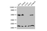 Western Blot<br />
Positive WB detected in:Hela whole cell lysate,Jurkat whole cell lysate,Mouse liver tissue,Mouse brain tissue,Mouse stomach tissue<br />
All lanes: COMMD1 antibody at 3.4ug/ml<br />
Secondary<br />
Goat polyclonal to rabbit IgG at 1/500