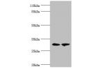 Western blot<br />
All lanes:ACBD4 antibody at 2ug/ml<br />
Lane 1:mouse kidney tissue<br />
Lane 2:mouse liver tissue<br />
Secondary<br />
Goat polyclonal to rabbit at 1/10000 dilution<br />
Predicted band size: 31,35,38 kDa<br />
Observed band size: 30