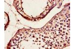 Immunohistochemistry of paraffin-embedded human testis tissue using CSB-PA818763LA01HU at dilution of 1:100