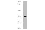 Western blot<br />
All lanes:GIMAP7 antibody at 2ug/ml+Jurkat whole cell lysate<br />
Secondary<br />
Goat polyclonal to rabbit at 1/10000 dilution<br />
Predicted band size: 35kDa<br />
Observed band size: 35kDa<br />