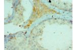 Immunohistochemistry of paraffin-embedded human testicle using CSB-PA818824ESR2HU at dilution 1:100